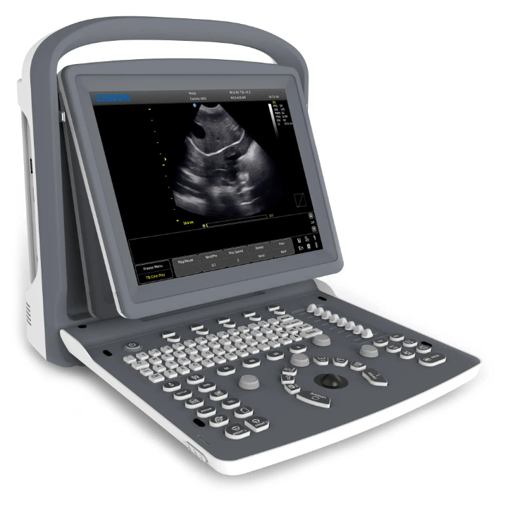 ECHOGRAPHE PORTATIF